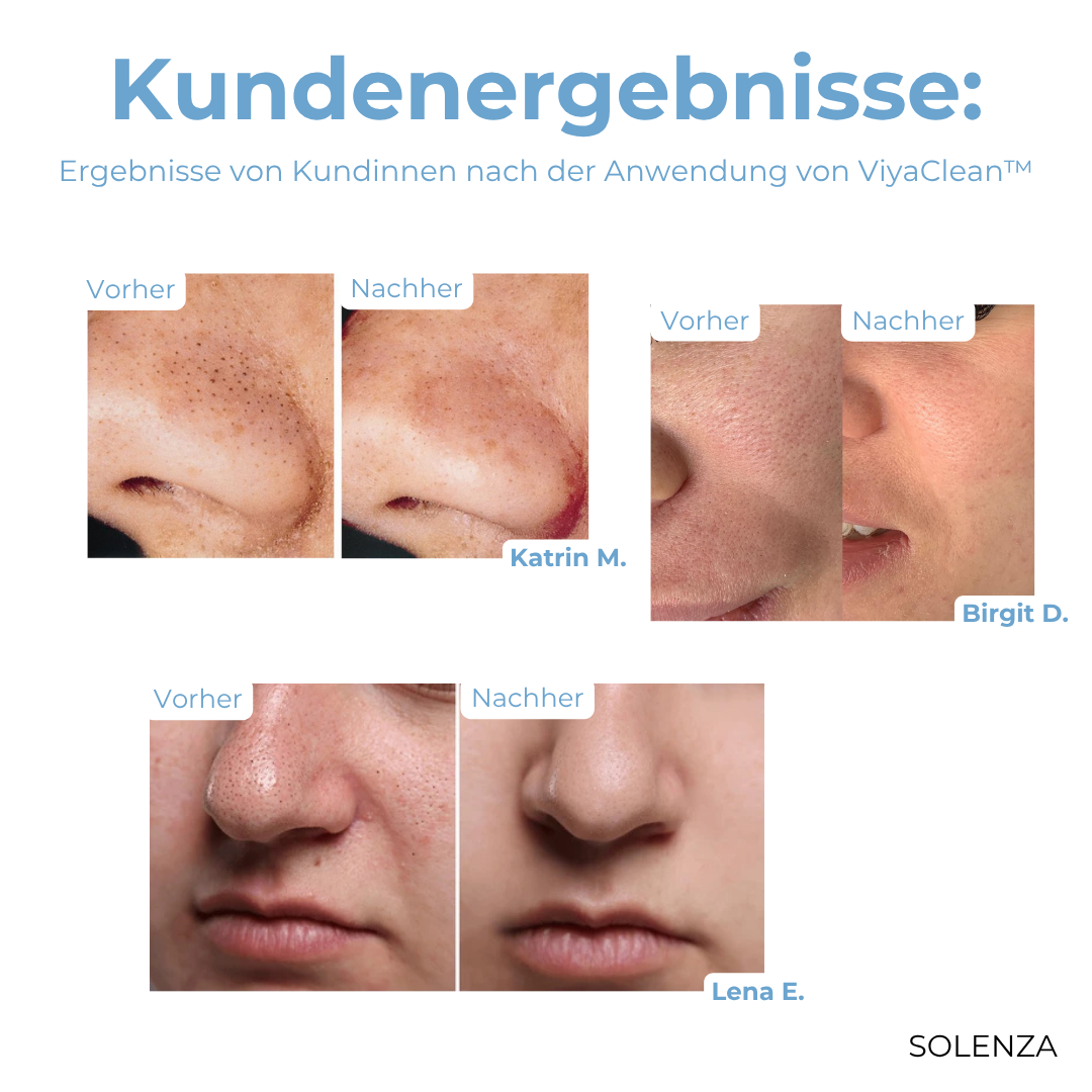 5+5 GRATIS | ViyaClean™ Porenreinigendes Serum