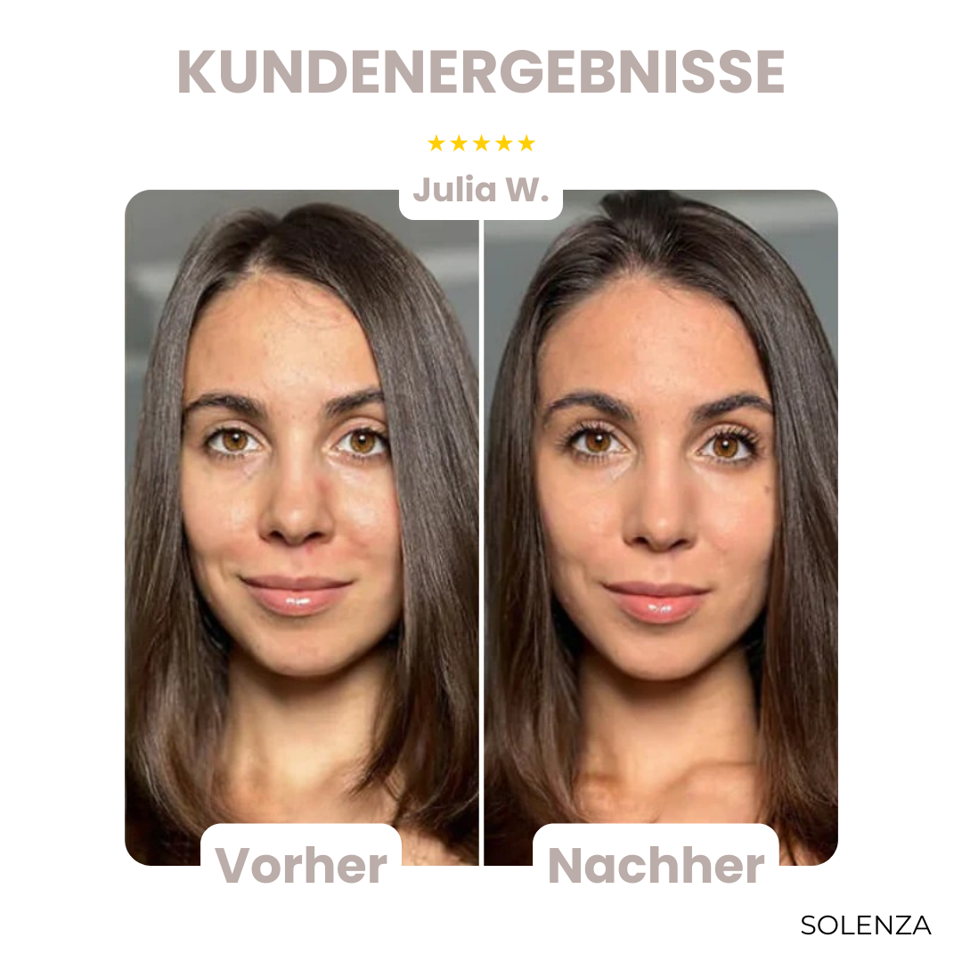 Letzter Tag -50% | SkinBlend™ 3-in-1 Korrekturpalette