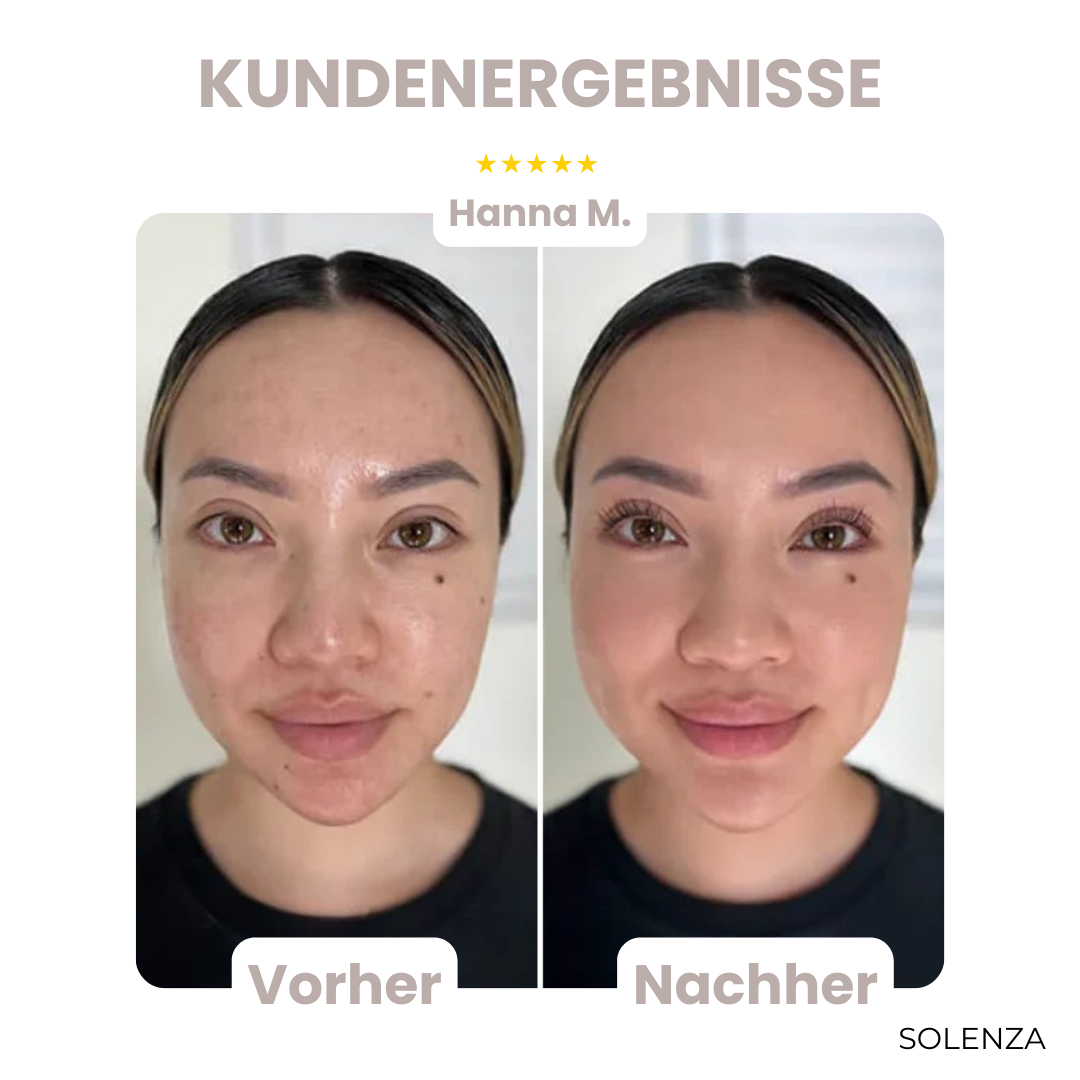 Letzter Tag -50% | SkinBlend™ 3-in-1 Korrekturpalette