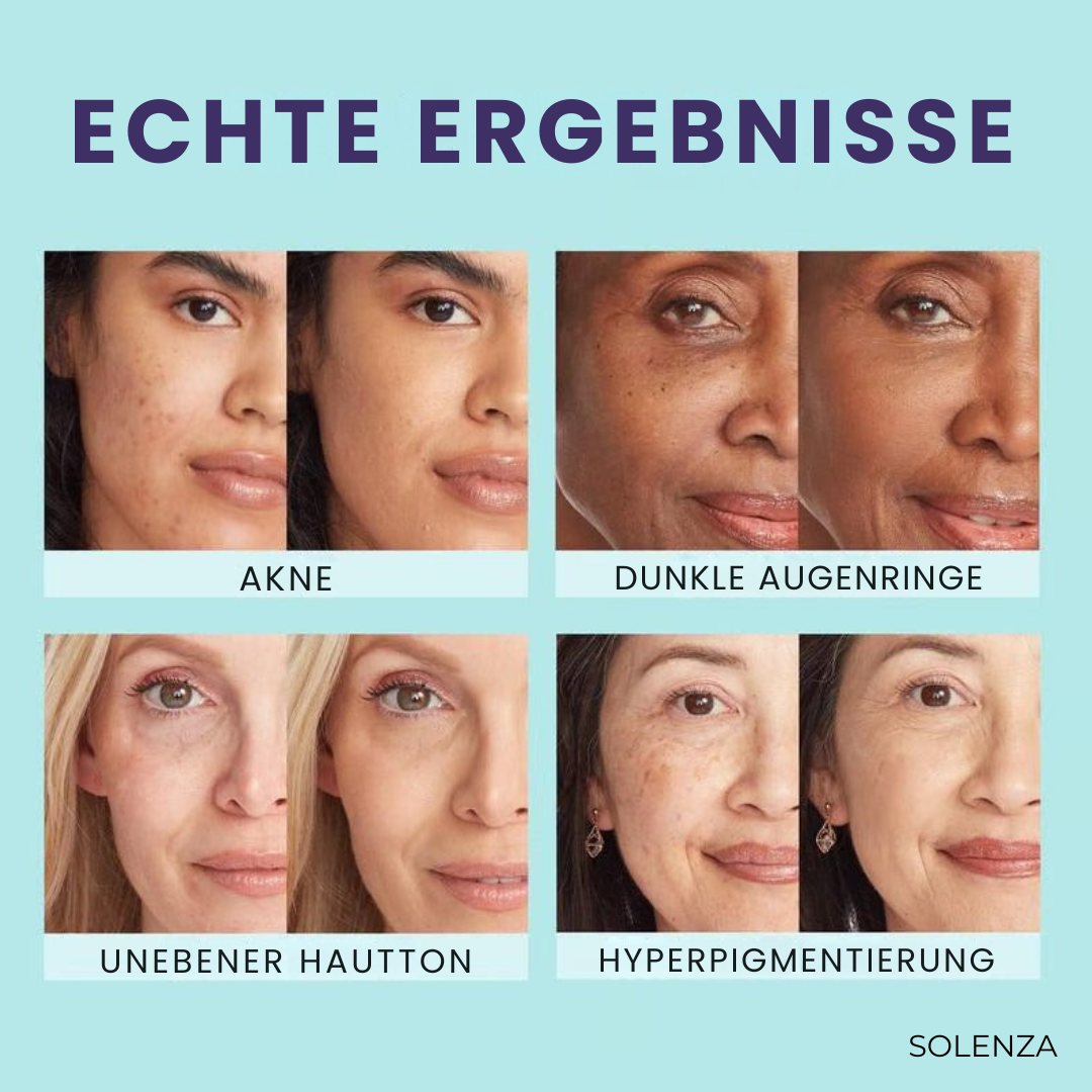 Letzter Tag -50%🔥 | GlowMist™ All-in-One Hautperfector