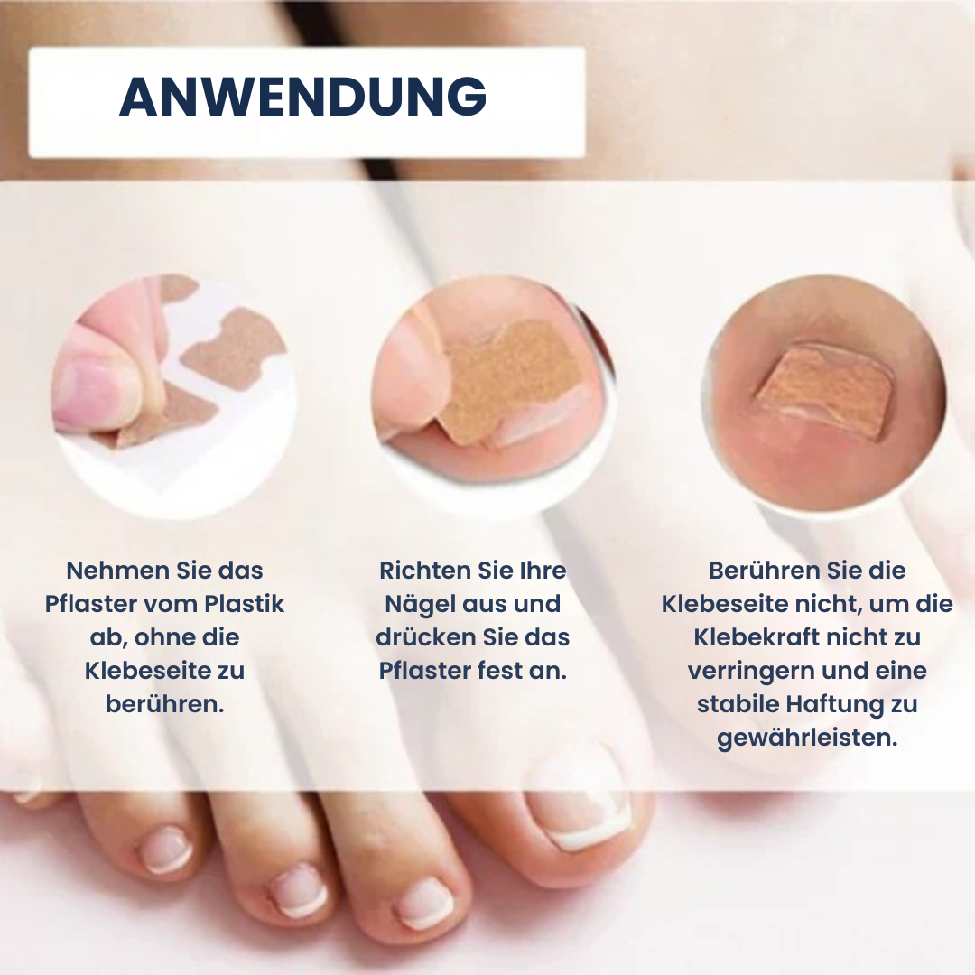 Letzter Tag -50% | PediPatch™ Nagelkorrigierende Pflaster (100 Stück)