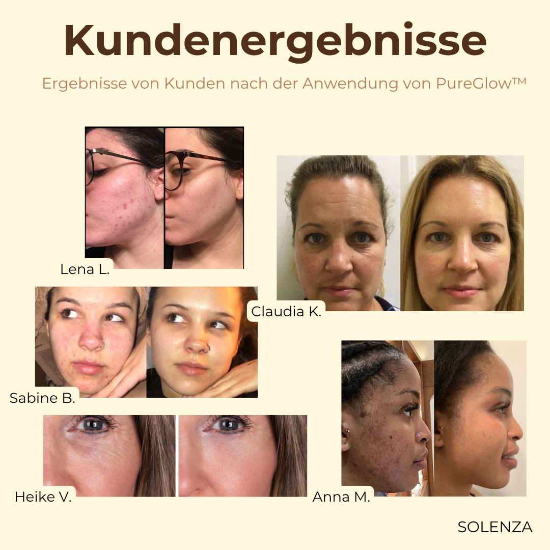 Letzter Tag -50% | PureGlow™ Schwarztee-Gesichtsmaske