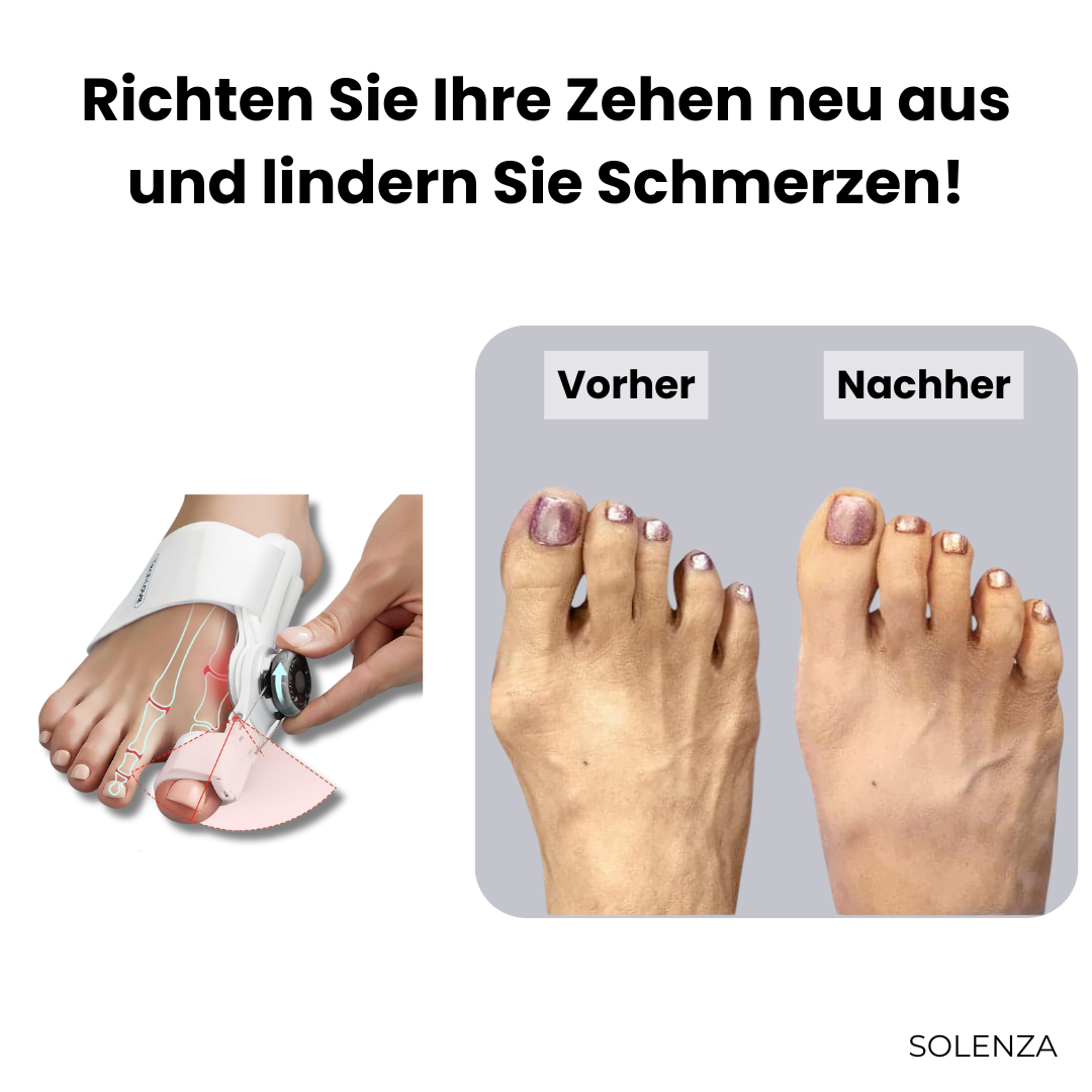Letzter Tag -50% | ToeAlign™ Korrekturschiene bei Hallux Valgus