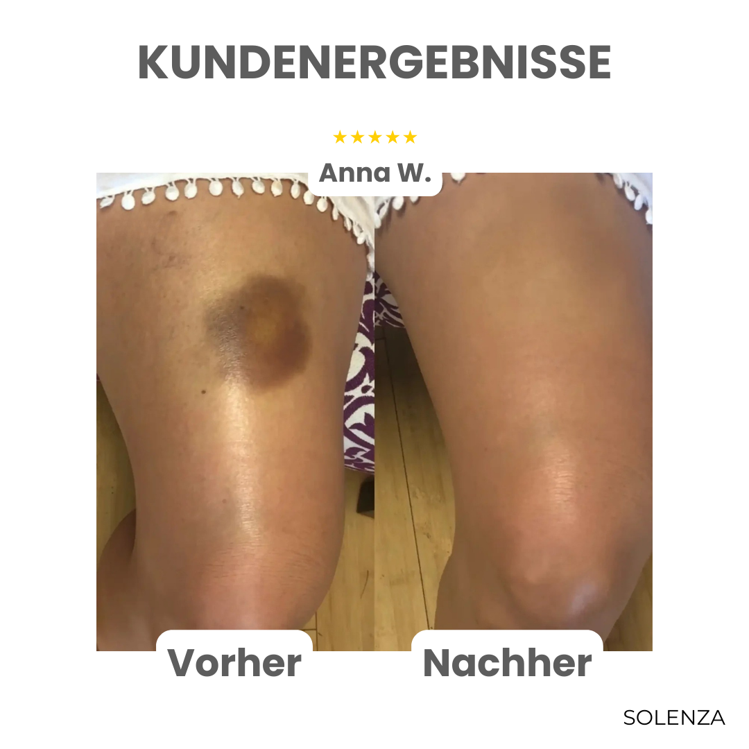 Letzter Tag -50% | GlowEase™ 3-in-1 Pflegecreme